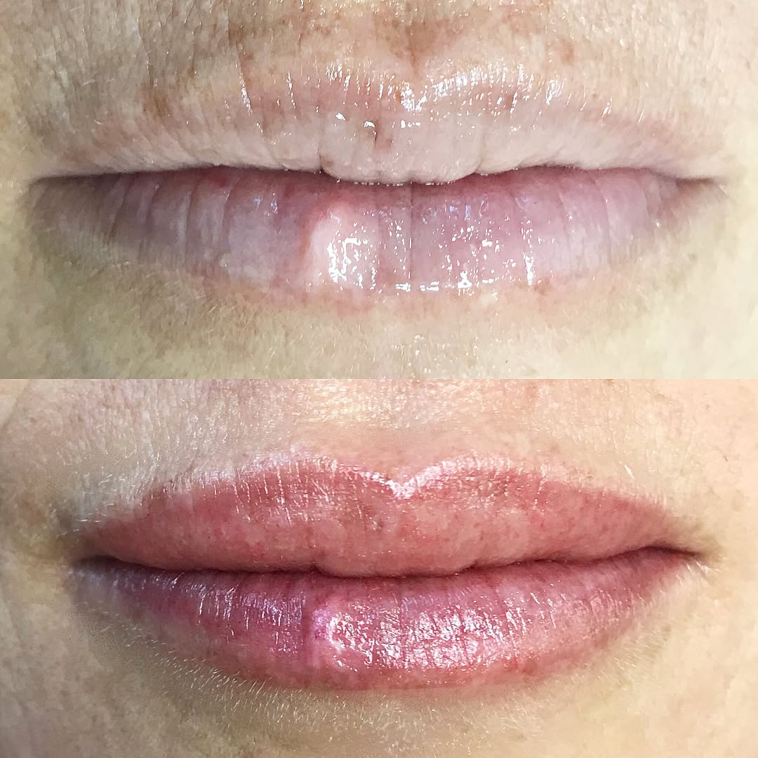 labios